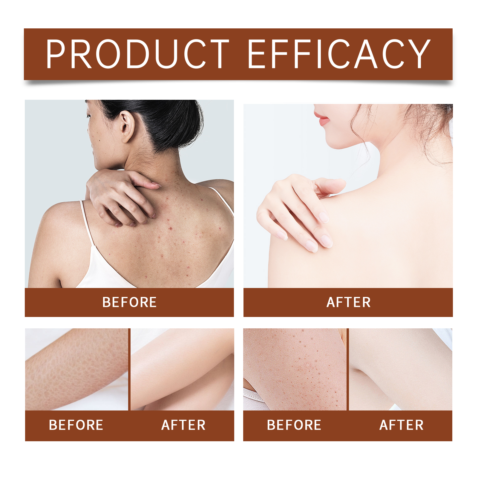 Luxury Body Oil for Dry Skin A - Luxury Skincare Gifts For Women recensione e prezzo